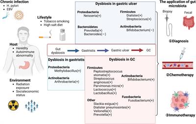 The role of the gut microbiota in gastric cancer: the immunoregulation and immunotherapy